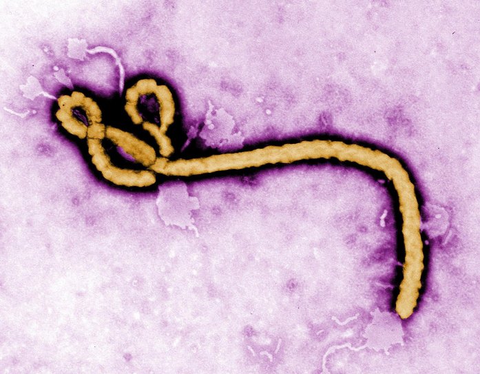 Статья "Вирус Эбола - начало конца?"